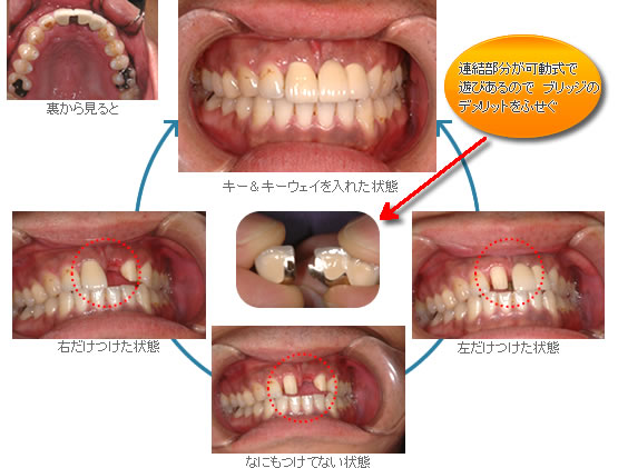 豊中市の歯医者 日本歯周病学会認定専門医 中垣歯科医院 噛み合わせ 痛みに配慮した治療など体に優しい歯科医院