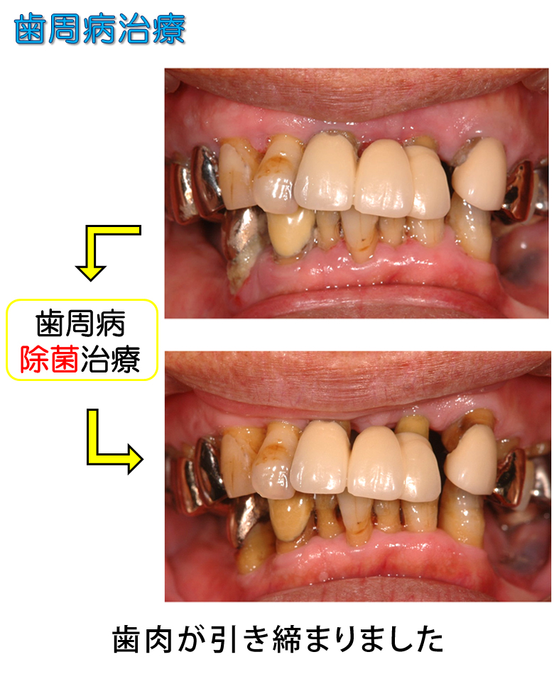 豊中市の歯医者 日本歯周病学会認定専門医 中垣歯科医院－噛み合わせ、痛みに配慮した治療など体に優しい歯科医院