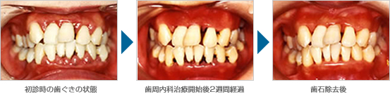 ��ǻ��λ������ξ��� �� ������ʼ��ų��ϸ�2���ַв� �� ���н����
