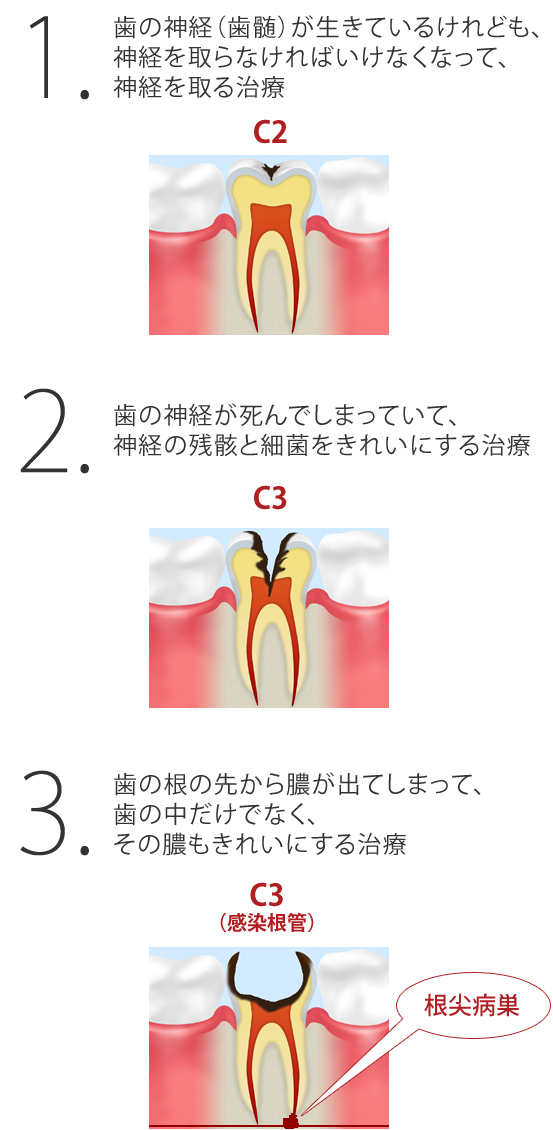 饫륷ࡢϤФ