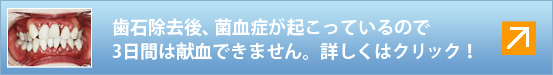 н塢ݷɤäƤΤ3֤ϸǤޤ󡣾ܤϥå