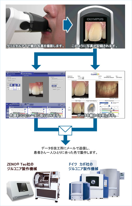 ꥹ륢