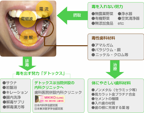 歯科材料