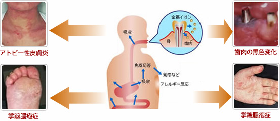 謁