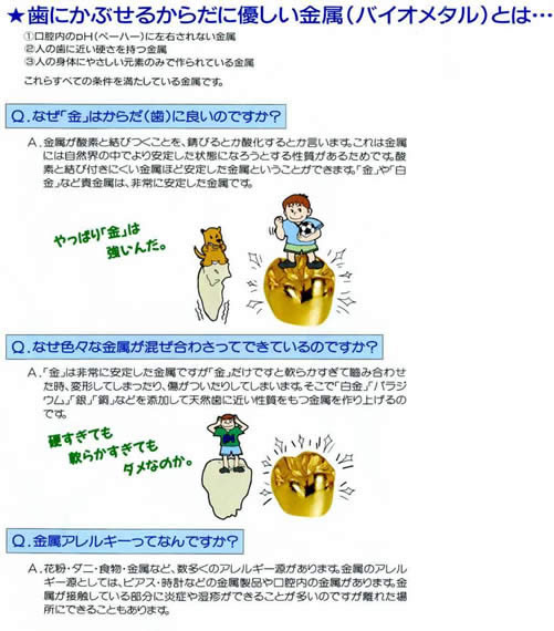 歯にかぶせるからだに優しい金属(バイオメタル)とは・・・