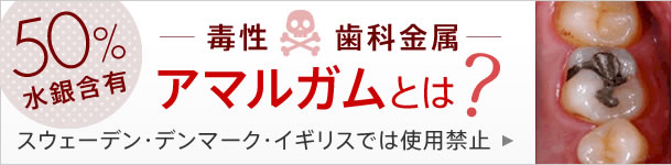 50%水銀含有の毒性歯科金属「アマルガム」とは？