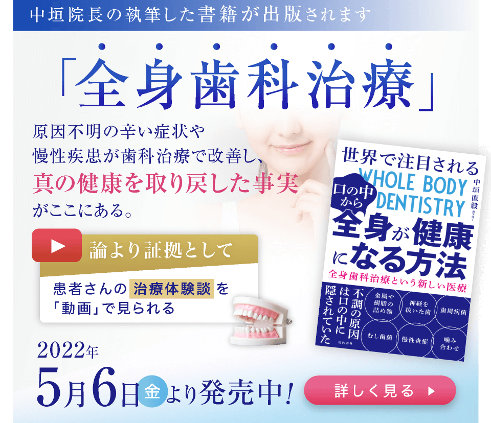 中垣院長の執筆した書籍が出版されます「全身歯科治療の本」