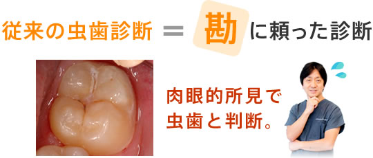 従来の勘に頼った虫歯診断