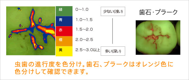 ケスラースカムの特徴