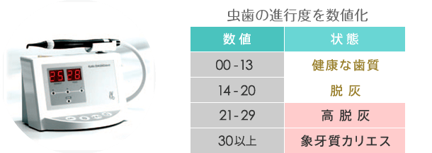 KAVO ダイアグノデント