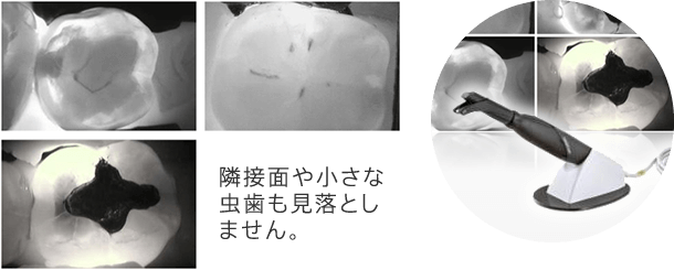 ダイアグノカム