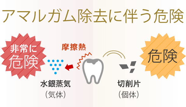 アマルガム除去に伴う危険