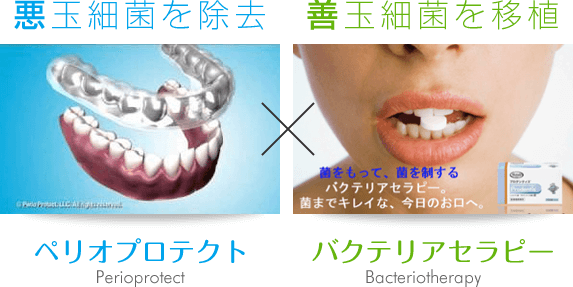 悪玉細菌を除去し善玉細菌を移植する