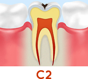 C2