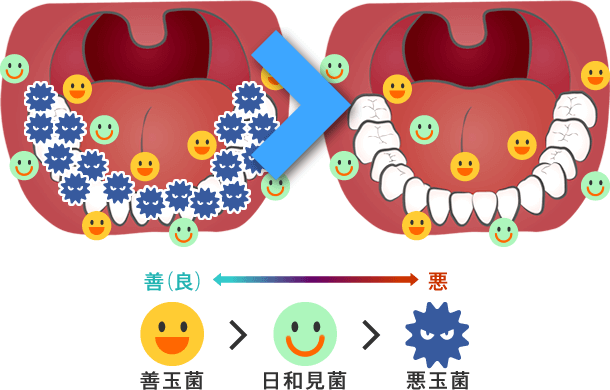 悪玉細菌の除菌イメージ