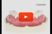 前歯治療のススメ 動画を見る
